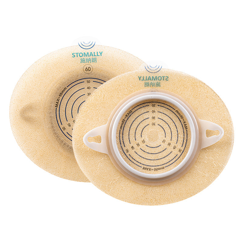 Understanding Changes in Stoma Size